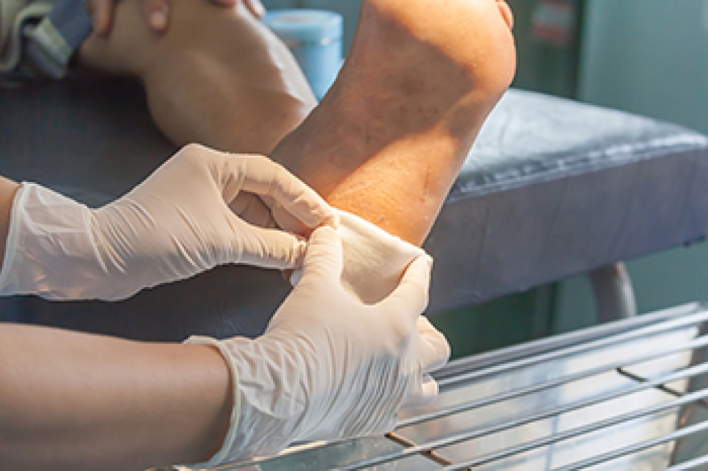Foot Puncture Wounds and Proper Treatment