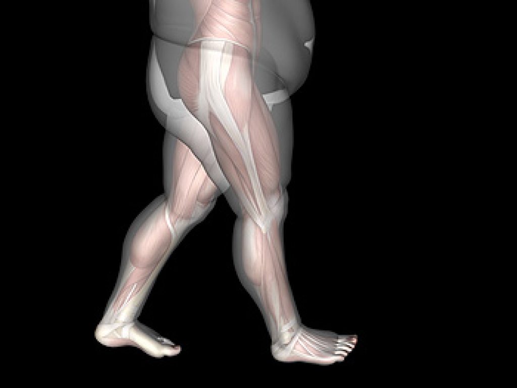 How Overweight Runners Can Protect Their Feet