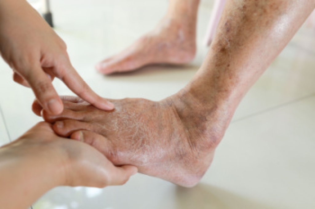 Aging and the Feet